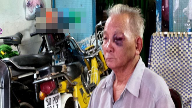 Người dân bị nhóm côn đồ đánh bị thương