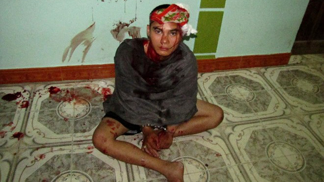 Hưng bị người dân đánh bị thương nặng