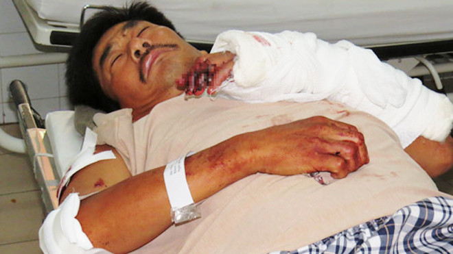 Ông Phạm Văn Tâm tại Khoa Cấp cứu Bệnh viện đa khoa tỉnh Khánh Hòa