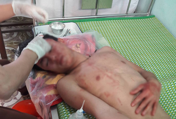 Em Tài điều trị tại bệnh viện.