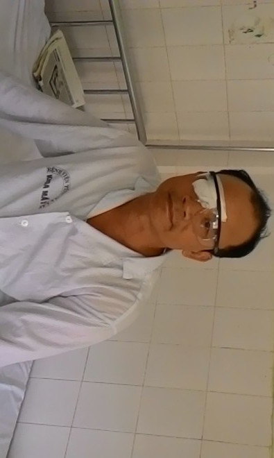 Ông Lợi bị đánh rách giác mạc 