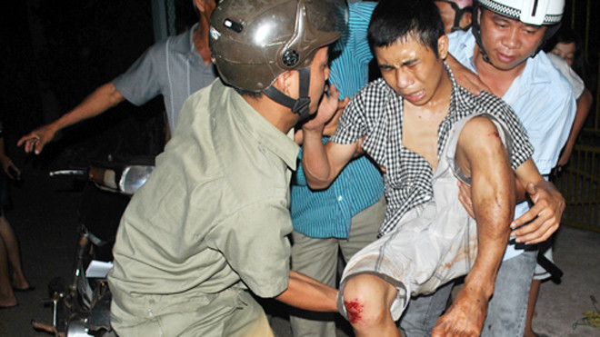 Tên trộm ngã gãy chân, được đưa đi cấp cứu. Ảnh: Xuân Mai