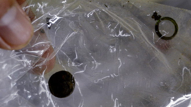 Viên pin mỏng dẹt to bằng cúc áo được lấy ra từ mũi bệnh nhân Cường. Ảnh: Ngọc Trường