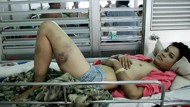 Tài đang điều trị tại bệnh viện Chợ Rẫy