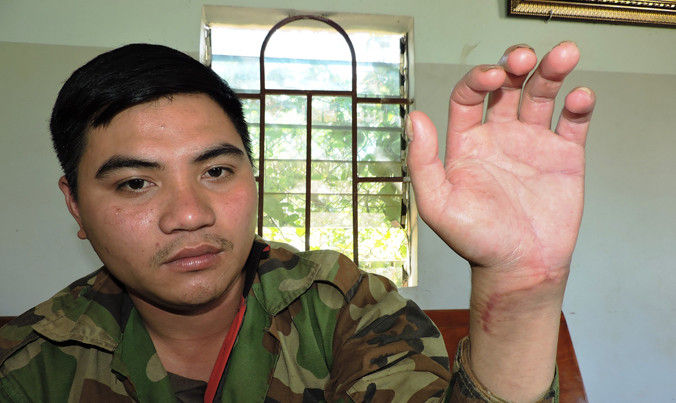 Anh Hương bị chém đứt gân tay.