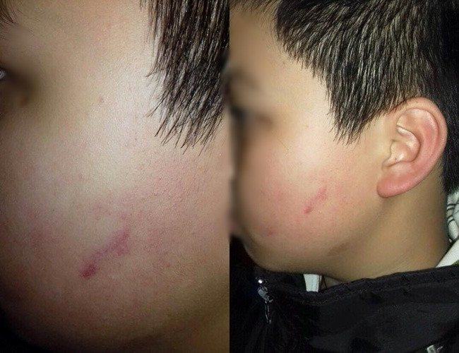 Chủ tịch Hà Nội: Làm rõ vụ giáo viên cho cả lớp tát vào mặt học sinh