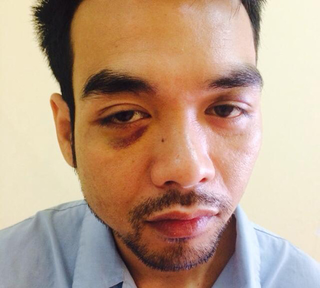 Bị đánh dập não vì chưa có tiền trả nợ