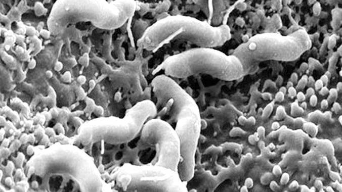 Vi khuẩn HP gây viêm dạ dày, thậm chí làm ung thư dạ dày