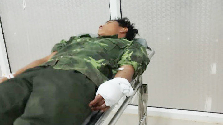 Anh Y Thông Chỉ Byă bị lâm tặc chém trọng thương