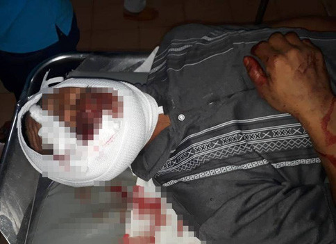 Ông Chìu bị thương nặng sau cuộc hỗn chiến