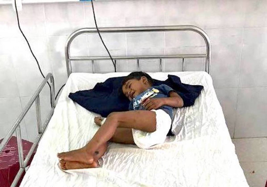 Hiện Vương đang được điều trị tại Bệnh viên Nhi tỉnh Gia Lai