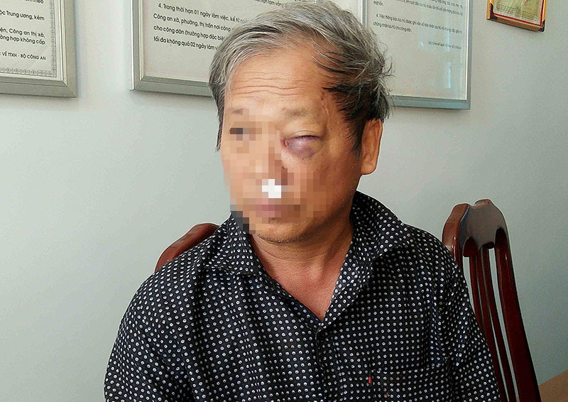 Nhà báo Hoàng Đình Chiểu tại Bệnh viện đa khoa tỉnh Kon Tum