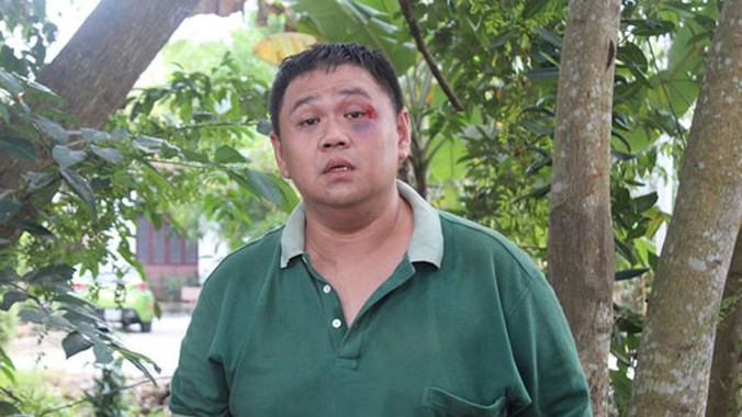 Người nhà đề nghị Dũng Taylor đứng ngoài chuyện của Minh Béo