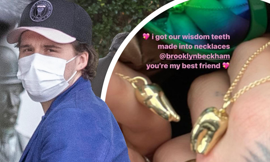 Cậu cả nhà Beckham và vị hôn thê hơn tuổi bọc vàng răng khôn làm tín vật tình yêu