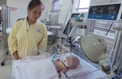 Bệnh nhi uốn ván đang được điều trị tích cực tại Bệnh viện Bệnh Nhiệt đới - Ảnh: Nguyên Mi.