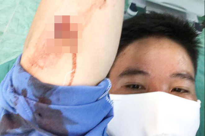 Ông Đặng Thanh Bình bị chủ nhà dùng cây sắt đánh bị thương. Ảnh: Nguyễn An/Zing.