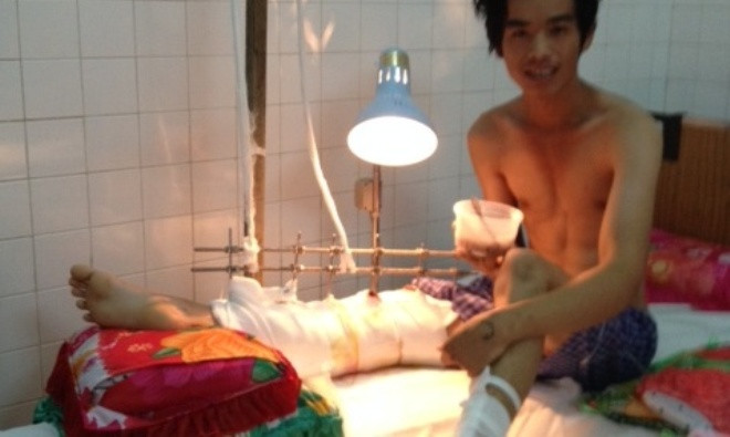 Bệnh nhân đã ổn định sau ca ghép có một không hai. Ảnh L.N