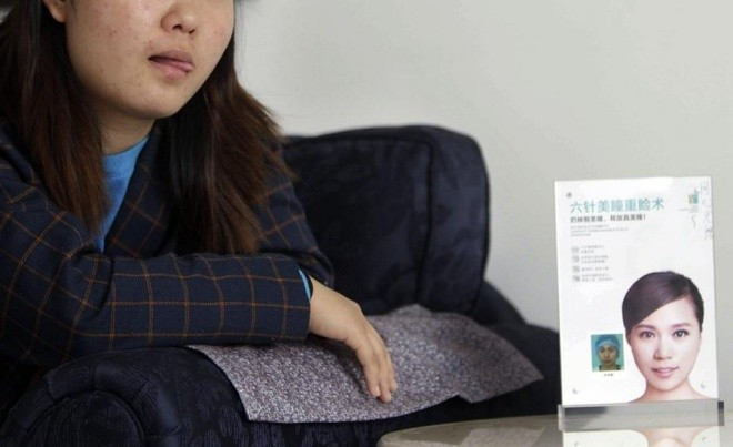 Do quá tự ti về vẻ bề ngoài của mình, Vũ Mông đã giấu bố mẹ thực hiện phẫu thuật thẩm mỹ.