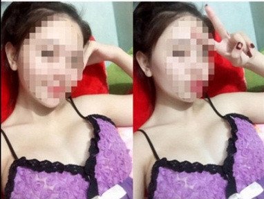 Vì sao nâng ngực lại có thể tử vong vì sốc nhiễm khuẩn?