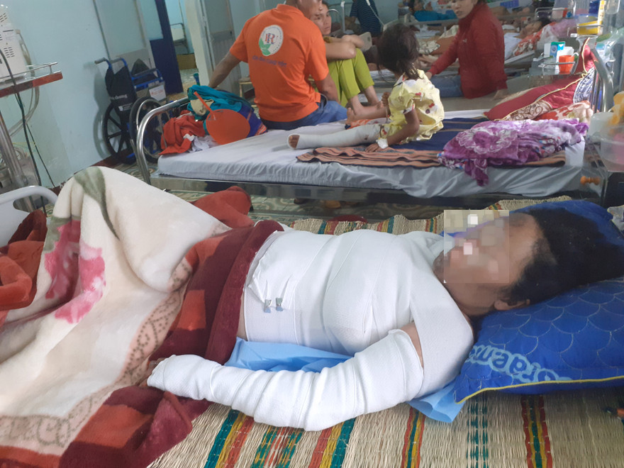 Chị T. bị phỏng nặng đang được điều trị tại bệnh viện 