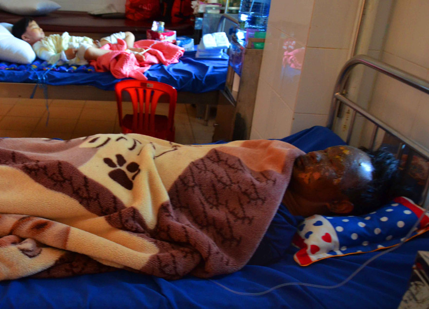 Dùng thuốc nổ tự chế pháo, anh H. bị cháy đen mặt nằm ở BV ĐK tỉnh Đắk Lắk