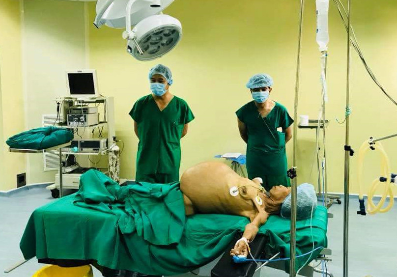 Khối u lớn chèn toàn bộ vùng bụng bệnh nhân. 