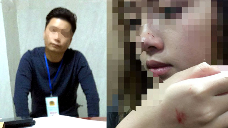 Chị P.H.V bị nhiều vết thương khi Đỗ Mạnh Hùng thực hiện hành vi sàm sỡ