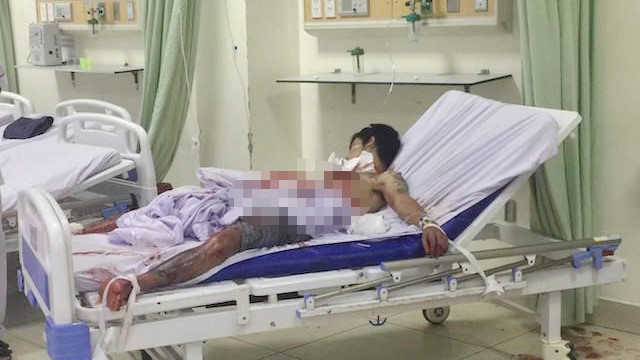 Nam bệnh nhân đang điều trị tain bệnh viện