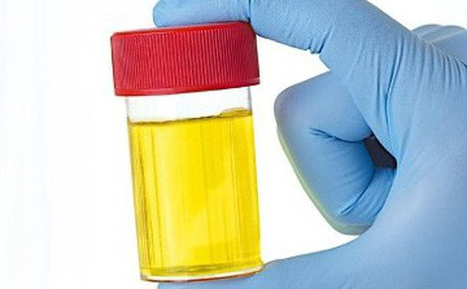 Bộ trưởng Ấn Độ muốn gom góp nước tiểu trên cả nước