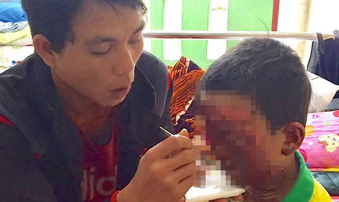 Em Xuyên nguy cơ hỏng mắt nếu không được chuyển viện gấp.