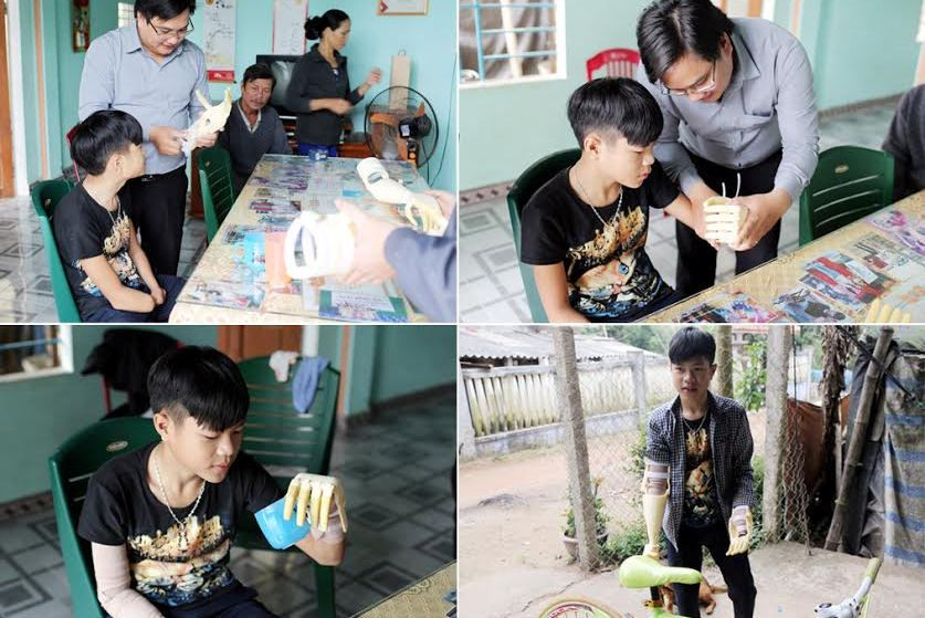 ThS. Đặng Ngọc Sỹ (đứng) lắp Cánh tay “Robot”cho em Phan Trọng Hiếu để em có thể uống nước, đi xe đạp.