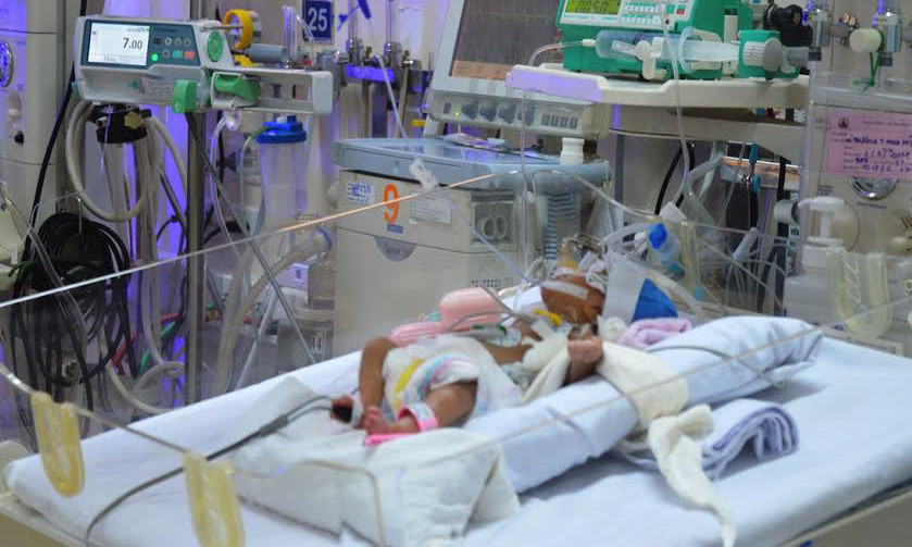 Cháu bé sinh non nặng chỉ 900gr.