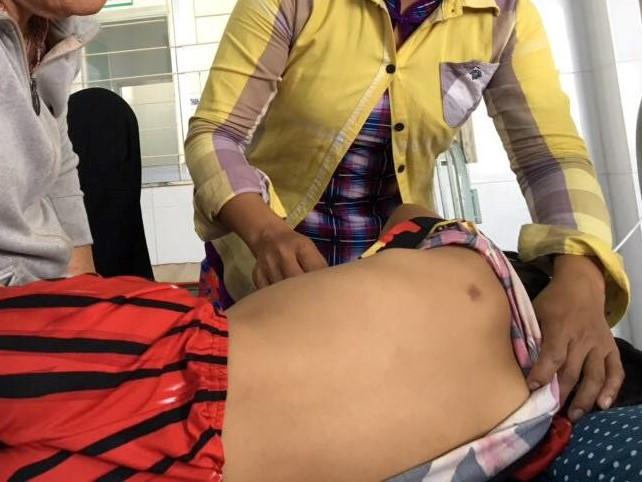 Vết thương trên vai nữ sinh lớp 4 bị kẻ lạ mặt dùng vật nhọn đâm.