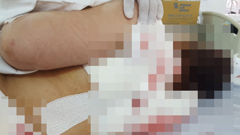 Chị Bé Hai được đưa vào Bệnh viện đa khoa tỉnh Vĩnh Long cấp cứu. Ảnh: Vietnamnet