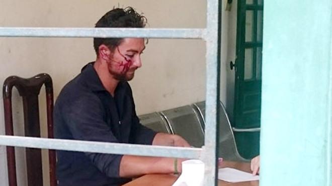 Thanh niên quốc tịch Đức đang bị tạm giữ để điều tra