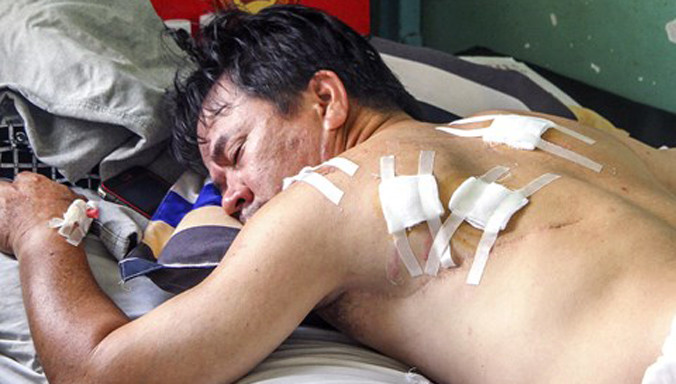 Anh Phụng đang được cấp cứu, điều trị tại bệnh viện Quân y 187.
