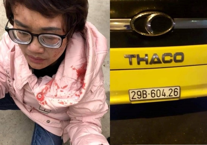 Chị Hằng sau khi bị hành hung và biển số xe khách được nhân chứng chụp lại