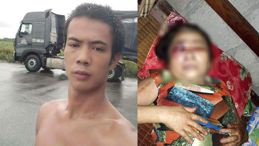 Mâu thuẫn trên chiếu bạc, người phụ nữ bị đánh hỏng mắt