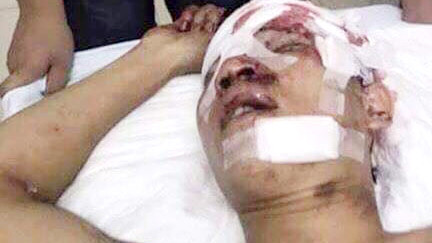 Hà Nội: Nhóm côn đồ hung hãn đuổi đánh hai người nguy kịch