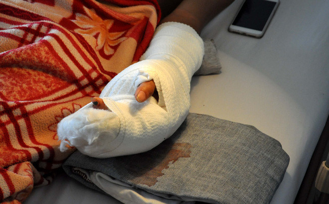 Côn đồ dùng mã tấu chém gần đứt lìa bàn tay học sinh