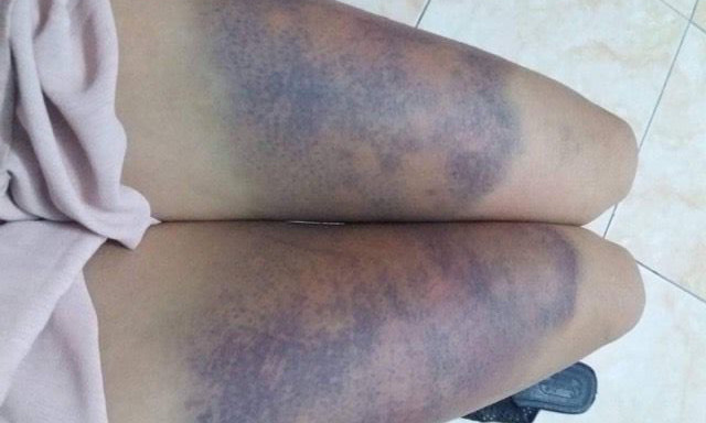 Hình ảnh Ngọc đăng lên mạng xã hội tố bạn trai hành hung. Ảnh: Facebook