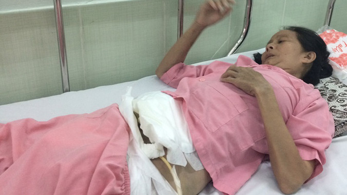 Bà Lợi khi còn điều trị tại khoa hồi sức - phẫu thuật tim, Bệnh viện Chợ Rẫy TPHCM. Ảnh: Quốc Ngọc.