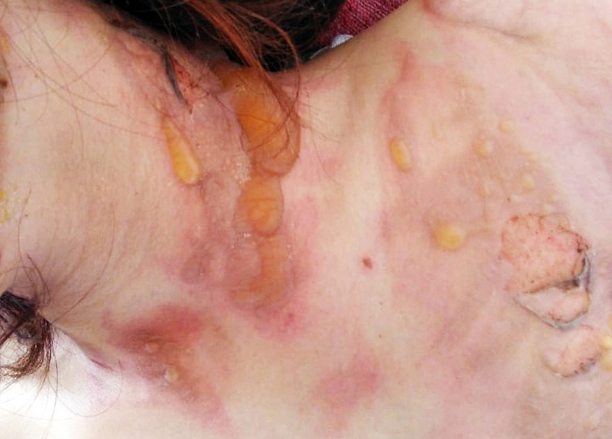 Vết thương trên người D.