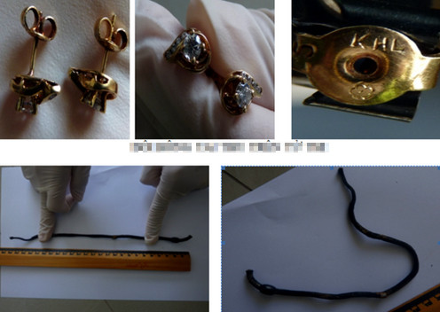 Đôi bông tai và dây buộc tóc được phát hiện cạnh bộ xương. Ảnh: PL TPHCM