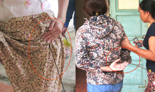 Người phụ nữ khác bị mũi tên trúng vào đùi và một nạn nhân khác bị mũi tên găm vào phần lưng