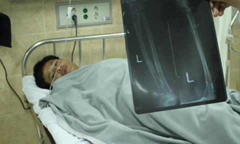 Chặn đầu xe tải để cướp, chém tài xế đứt gân tay