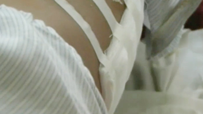 Đại úy Tống Văn Tiễn bị trúng 1 nhát dao ở vùng lưng gây thương tích nặng