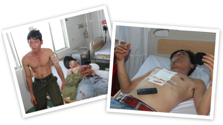 Những vết thương khá nghiêm trọng trên cơ thể các nhân viên bảo vệ