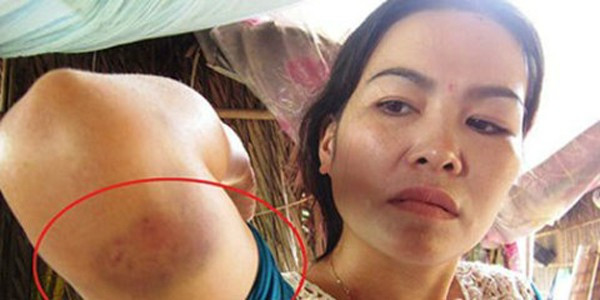 Cô gái tố cáo bị viên công an huyện sàm sỡ