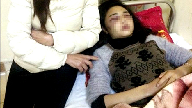 Em Trần Thị Anh Thơ điều trị tại Bệnh viện Đa khoa tỉnh Hà Tĩnh - Ảnh: Công Dũng